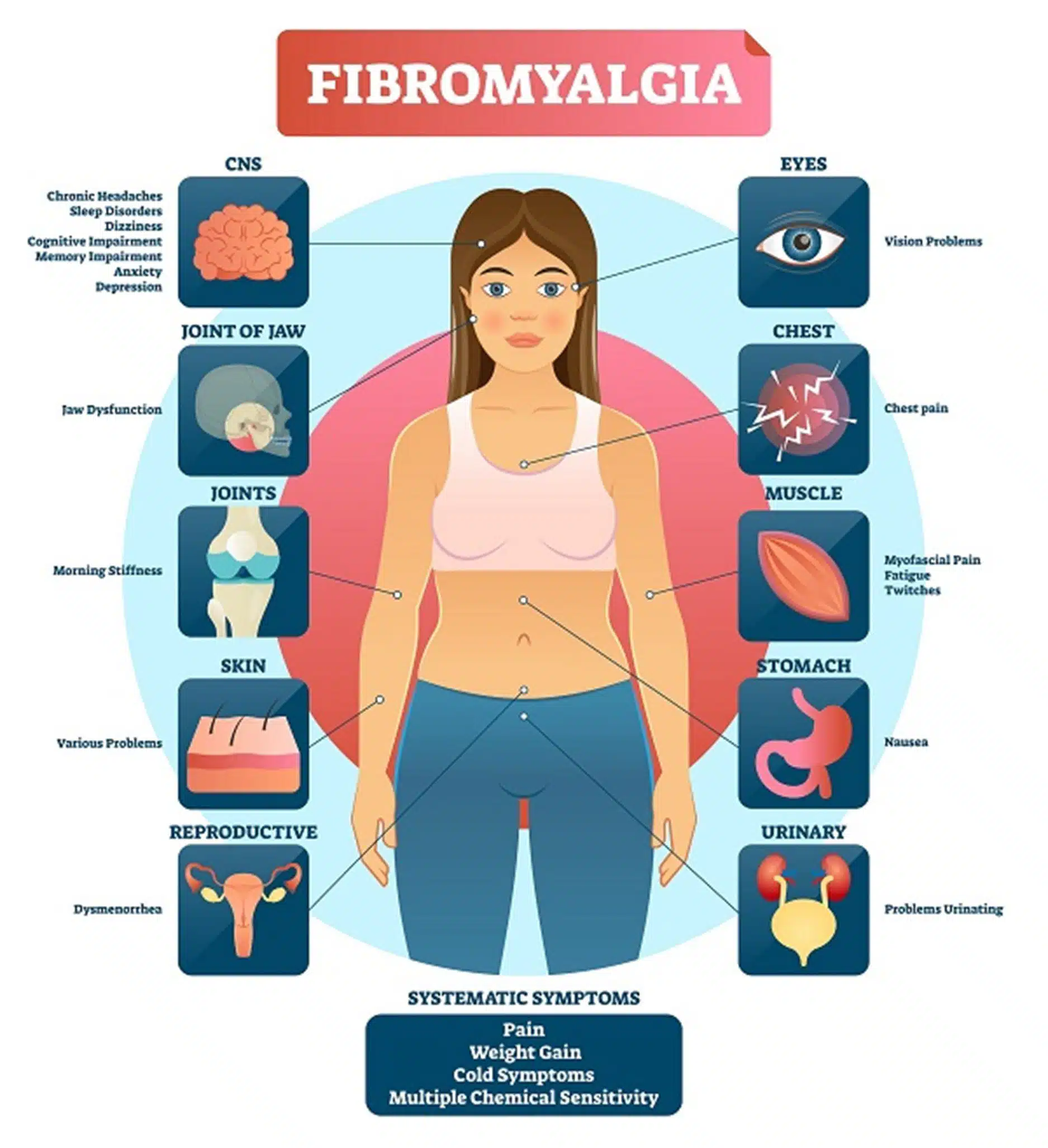 Fibromyalgia illustration