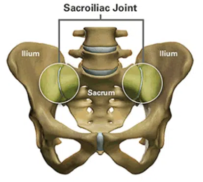 Sacroiliac Joint illustration